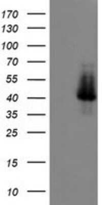 Western Blot: ELK3 Antibody (OTI1H3) [NBP2-01264]