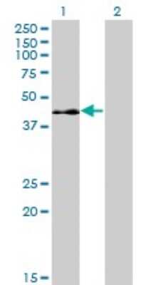 Western Blot: ELK3 Antibody (3A12) [H00002004-M02]