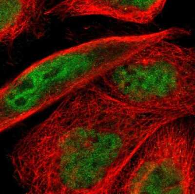 Immunocytochemistry/ Immunofluorescence: ELK3 Antibody [NBP1-83960]