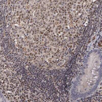 Immunohistochemistry-Paraffin: ELK3 Antibody [NBP1-83960]