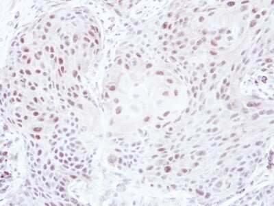 Immunohistochemistry-Paraffin: ELK3 Antibody [NBP2-16315]