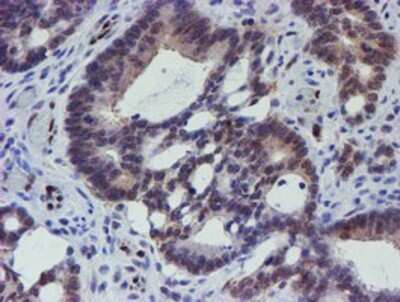 Immunohistochemistry: ELK3 Antibody (OTI1H3) - Azide and BSA Free [NBP2-70643]