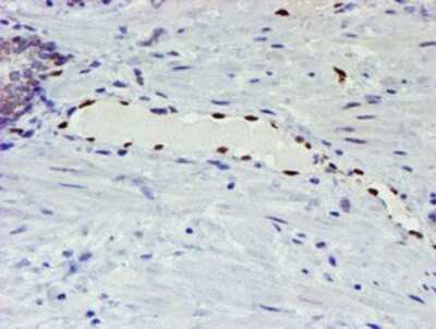 Immunohistochemistry: ELK3 Antibody (OTI1H3) - Azide and BSA Free [NBP2-70643]