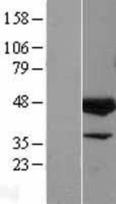 Western Blot: ELK3 Overexpression Lysate [NBL1-10233]