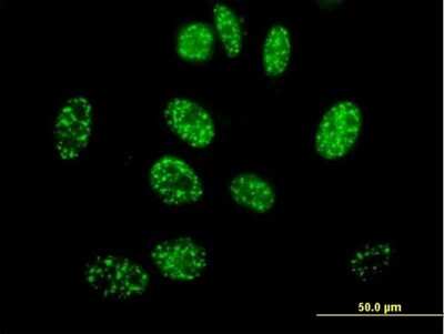 Immunocytochemistry/ Immunofluorescence: ELK4 Antibody [H00002005-B01P]