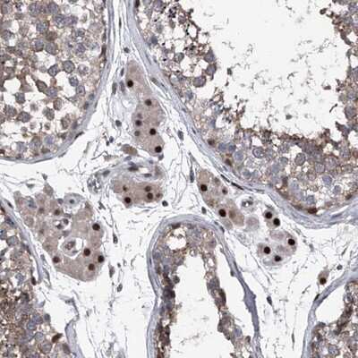 Immunohistochemistry-Paraffin: ELK4 Antibody [NBP1-87092]