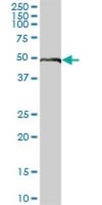 Western Blot: ELK4 Antibody [H00002005-B01P]