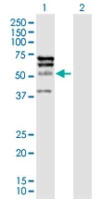 Western Blot: ELK4 Antibody [H00002005-D01P]