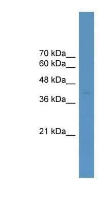 Western Blot: ELK4 Antibody [NBP1-69129]