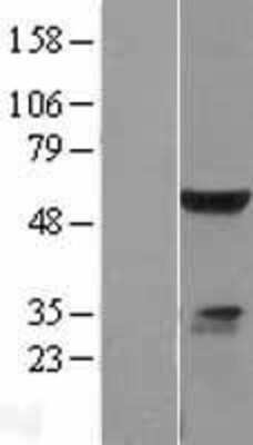 Western Blot: ELK4 Overexpression Lysate [NBL1-10234]