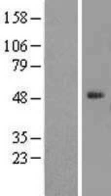 Western Blot: ELK4 Overexpression Lysate [NBL1-10235]