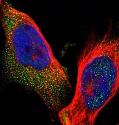 Immunocytochemistry/ Immunofluorescence: ELKS Antibody [NBP1-88177]