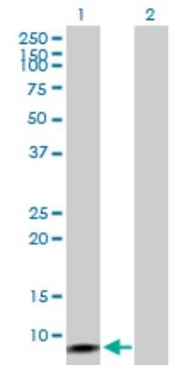 Western Blot: ELKS Antibody [H00023085-B01P]