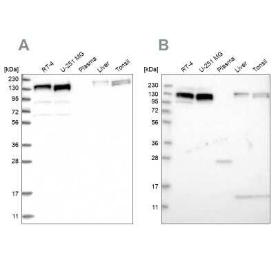 Western Blot: ELKS Antibody [NBP1-88177]