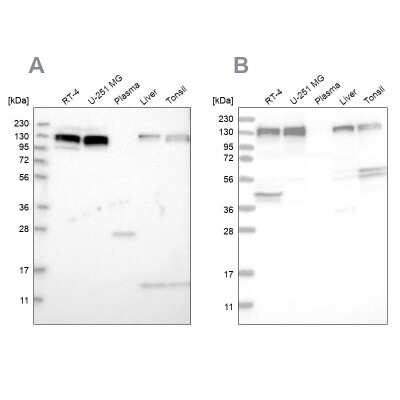 Western Blot: ELKS Antibody [NBP1-88179]