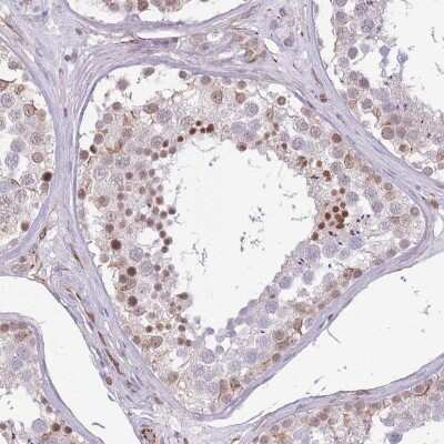 Immunohistochemistry-Paraffin: ELL Antibody [NBP2-13955]