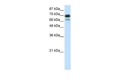 Western Blot: ELL Antibody [NBP2-82991]