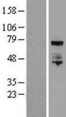 Western Blot: ELL Overexpression Lysate [NBL1-10236]