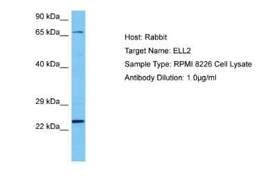 Western Blot: ELL2 Antibody [NBP2-84847]