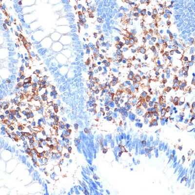 Immunohistochemistry-Paraffin: ELMO1 Antibody (9X6Y6) [NBP3-16410]