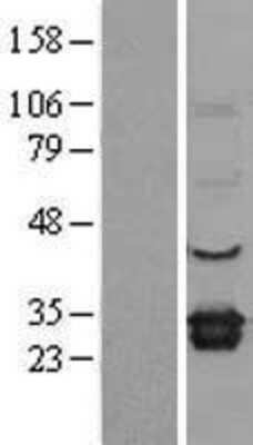 Western Blot: ELMO1 Overexpression Lysate [NBL1-10239]