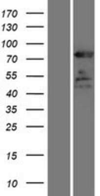 Western Blot: ELMO1 Overexpression Lysate [NBP2-09868]