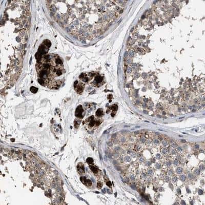 Immunohistochemistry-Paraffin: ELMO3 Antibody [NBP1-85695]