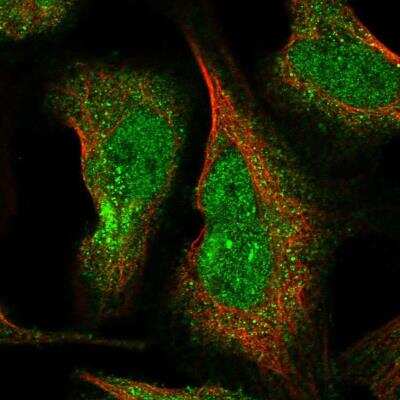 Immunocytochemistry/ Immunofluorescence: ELMOD1 Antibody [NBP1-85093]