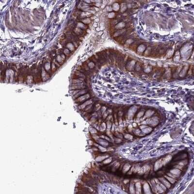 Immunohistochemistry-Paraffin: ELMOD2 Antibody [NBP2-13956]