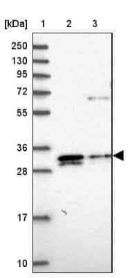 Western Blot: ELMOD2 Antibody [NBP2-13956]