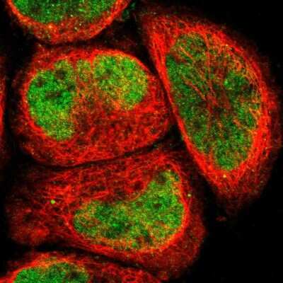 Immunocytochemistry/ Immunofluorescence: ELMSAN1 Antibody [NBP1-88407]