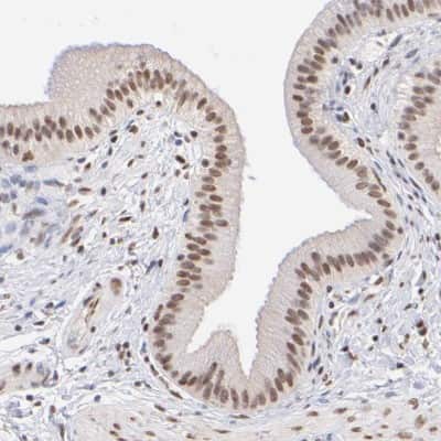 Immunohistochemistry-Paraffin: ELMSAN1 Antibody [NBP1-88407]