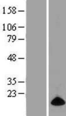 Western Blot: ELOF1 Overexpression Lysate [NBP2-06038]