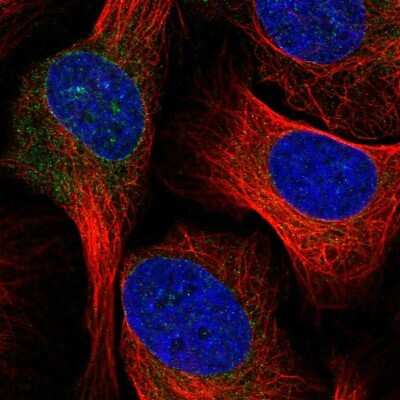 Immunocytochemistry/ Immunofluorescence: ELOVL1 Antibody [NBP2-37956]