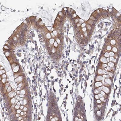 Immunohistochemistry-Paraffin: ELOVL1 Antibody [NBP2-37956]
