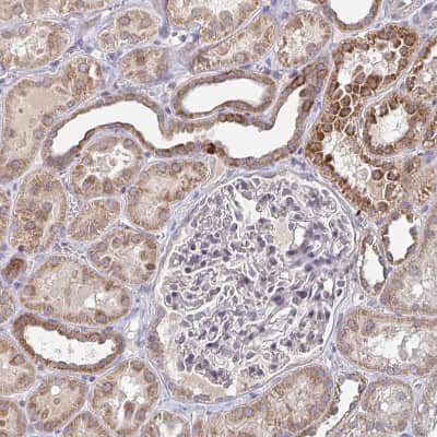 Immunohistochemistry-Paraffin: ELOVL1 Antibody [NBP2-37956]