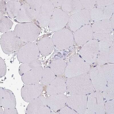 Immunohistochemistry-Paraffin: ELOVL1 Antibody [NBP2-37956]