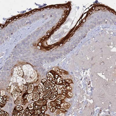 Immunohistochemistry-Paraffin: ELOVL1 Antibody [NBP2-37956]