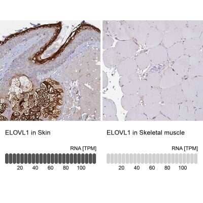 Immunohistochemistry-Paraffin: ELOVL1 Antibody [NBP2-37956]