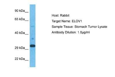 Western Blot: ELOVL1 Antibody [NBP2-82997]