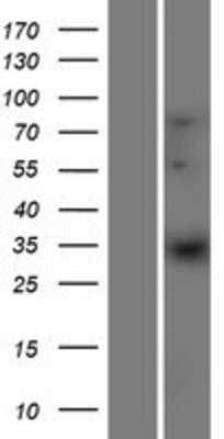 Western Blot: ELOVL1 Overexpression Lysate [NBP2-06398]