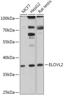 Western Blot: ELOVL2 AntibodyAzide and BSA Free [NBP3-04888]