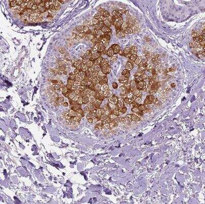 Immunohistochemistry-Paraffin: ELOVL3 Antibody [NBP1-85618]