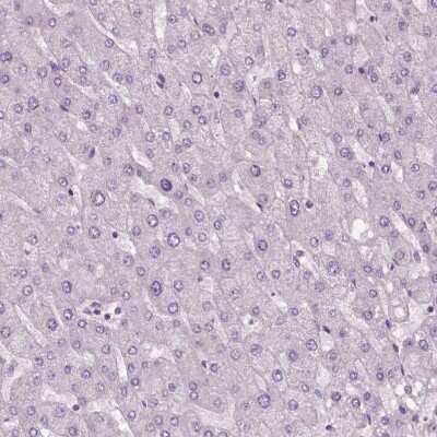 Immunohistochemistry-Paraffin: ELOVL3 Antibody [NBP1-85618]