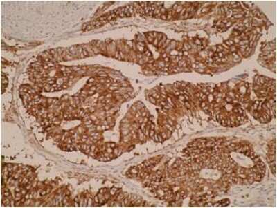 Immunohistochemistry: ELOVL3 Antibody (V61 P2B3*D10) - BSA Free [NBP2-50385]