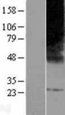 Western Blot: ELOVL3 Overexpression Lysate [NBP2-05402]