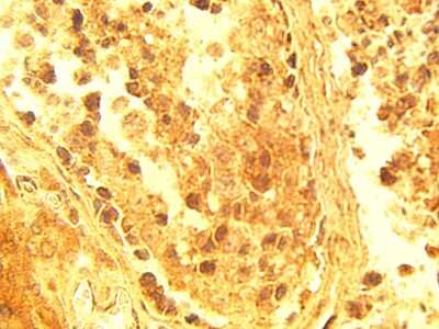 Immunohistochemistry: ELOVL4 Antibody [NBP3-11920]