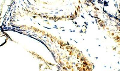 Immunohistochemistry-Paraffin: ELOVL4 Antibody [NBP3-12303]