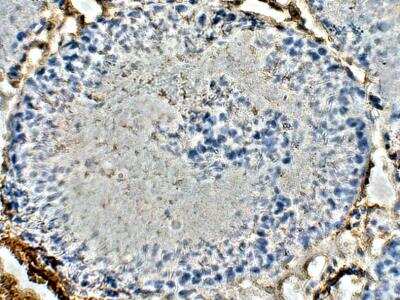 Immunohistochemistry-Paraffin: ELOVL4 Antibody [NBP3-12304]