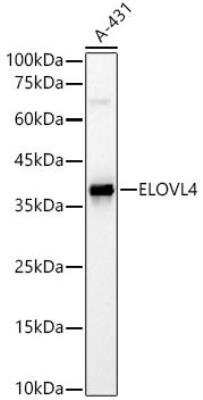 Western Blot: ELOVL4 AntibodyAzide and BSA Free [NBP3-03895]